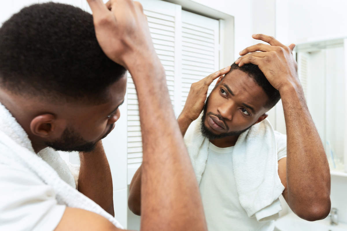 Hairloss concept. Young african man checking for thinning hair in mirror at bathroom